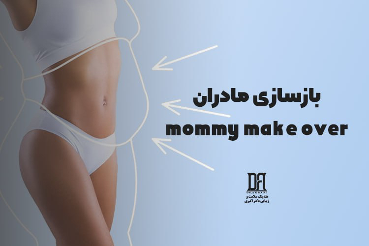 بازسازی مادر یا Mommy Makeover  چیست؟